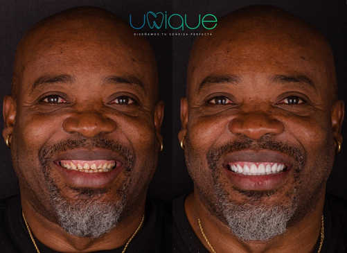 Slider image (5) Unique Dental Clinic